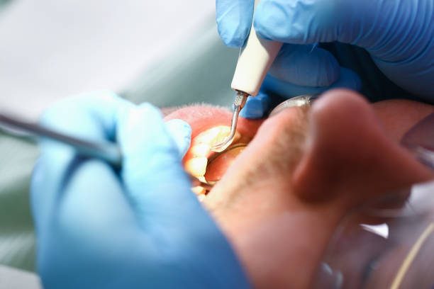Best Emergency Dental Surgery in Sturtevant, WI