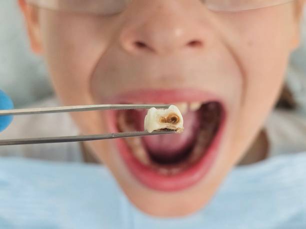Best Emergency Broken Tooth Repair in Sturtevant, WI