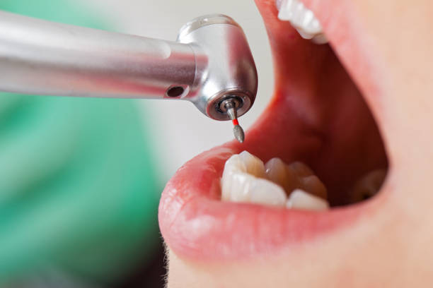 Best Emergency Treatment for Toothache in Sturtevant, WI